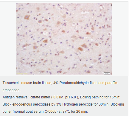 605942a4d5991.png image.png