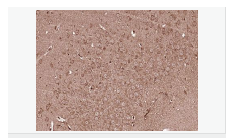 60598b6f296f0.png image.png